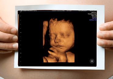 Best 3D Doppler Scan Hospital in Mudichur