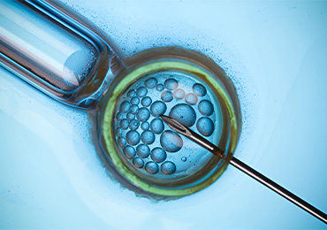 Best Micro Tesa Treatment in Tambaram