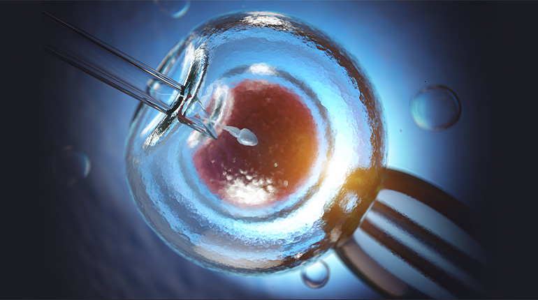Best Sperm Retrieval Treatment in Tambaram