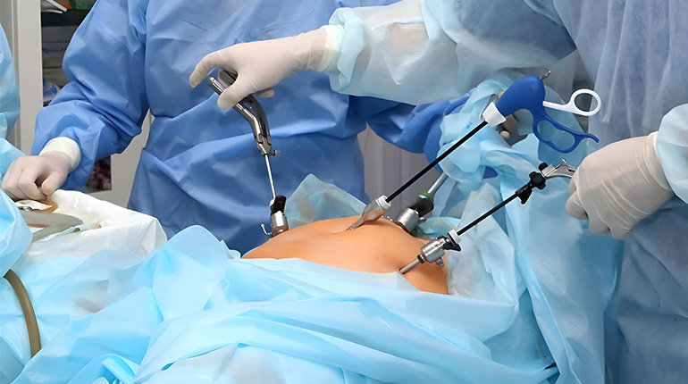 Best Laparoscopic Surgeons in Mudichur