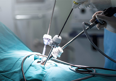 Laparoscopic Treatment in Tambaram