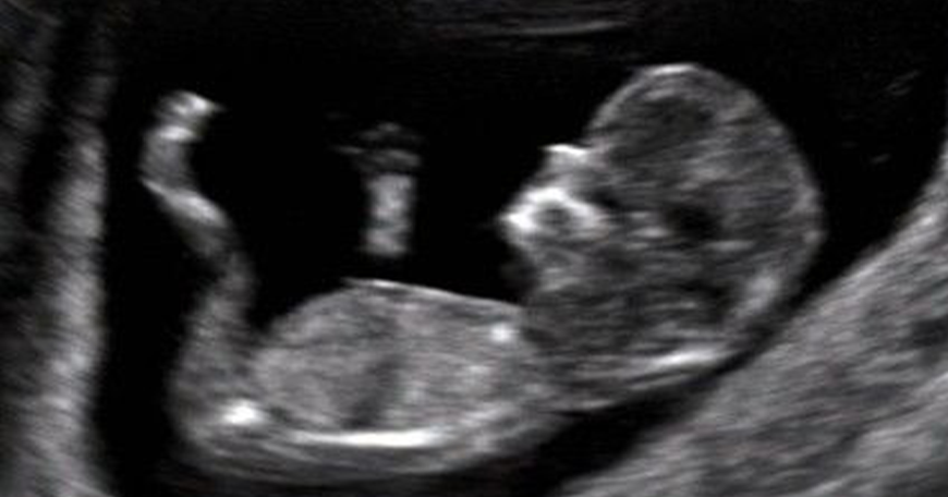 Best NT Scan Hospital in Tambaram