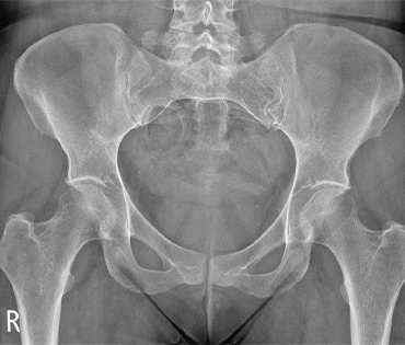 Pelvic Ultrasound Scan in Mudichur