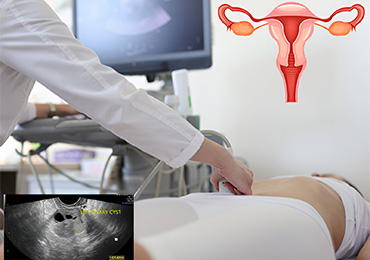 Pelvic Ultrasound Scan in Tambaram 