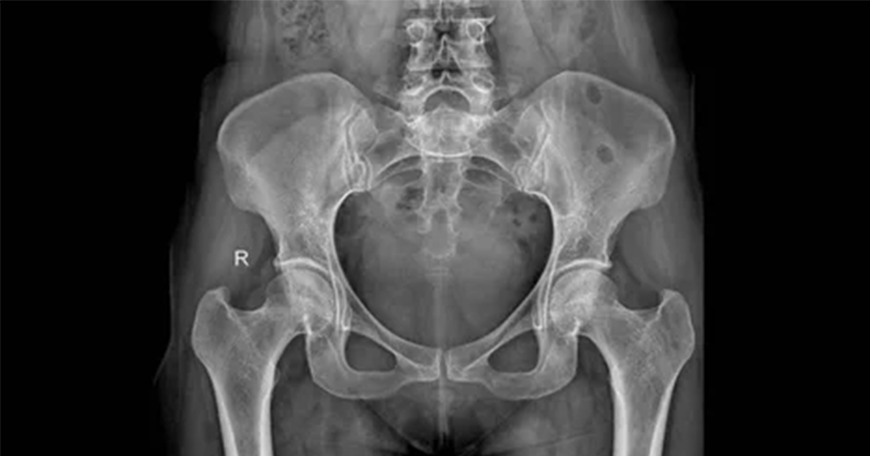 Pelvic Ultrasound Scan in Tambaram