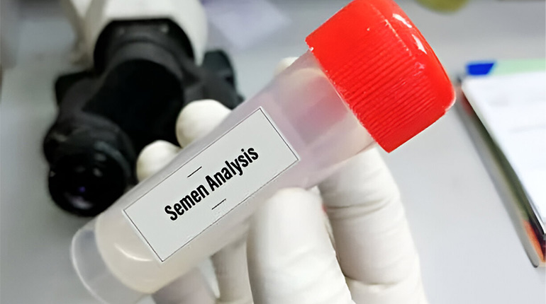 Semen Analysis test in Mudichur