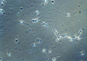 Semen Analysis test in Tambaram