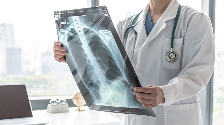 Top X-Ray Service in Tambaram